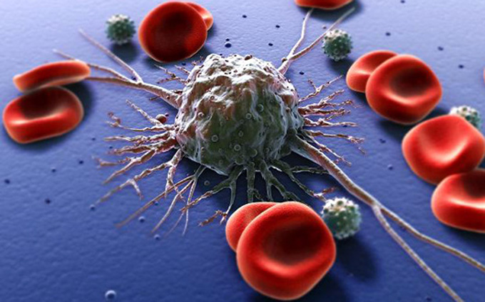 cancer-tratament-celule-canceroase