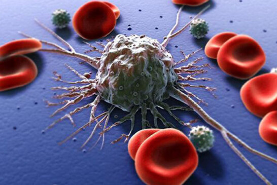 Celulele canceroase „infometate” sunt o cheie pentru noile tratamente impotriva tumorilor 