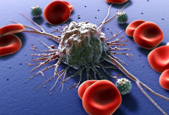 Celulele canceroase „infometate” sunt o cheie pentru noile tratamente impotriva tumorilor 