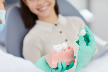 Implantul dentar: cea mai bună soluție pentru înlocuirea unui dinte